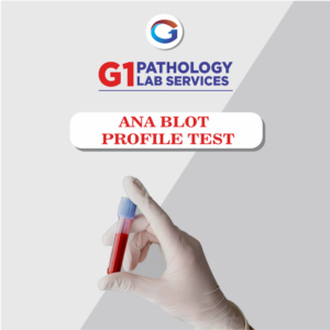 www.g1pathlab.in_ ANA BLOT PROFILE_Test