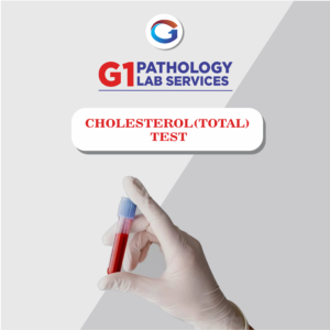 Total Cholesterol