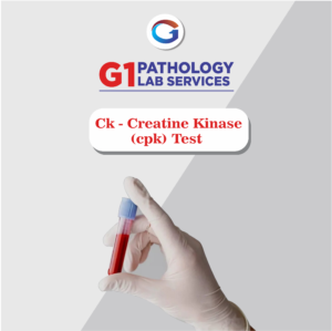 Creatine Kinase (CPK)