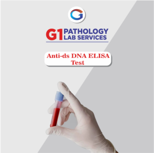 Anti Dsdna Elisa