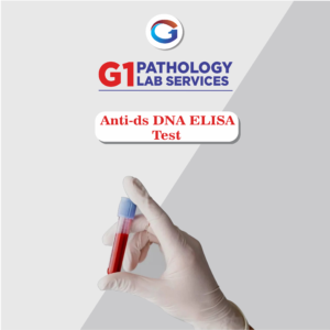 Anti Dsdna Elisa
