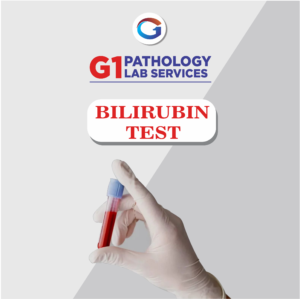 Bilirubin D
