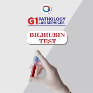 Bilirubin D