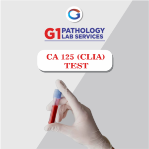 Ca 125(Clia)