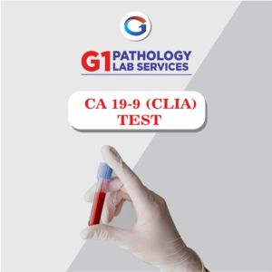 Ca 19-9(Clia)