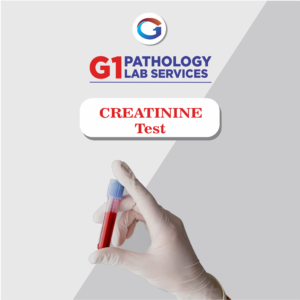 Creatinine