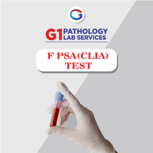 Free Prostrate Specific Antigen  (Free PSA For Men)