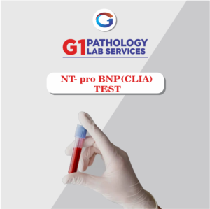 NT-pro BNP