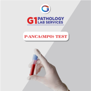 Perinuclear Antineutrophil Cytoplasmic Antibodies (P-ANCA)