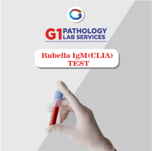 Rubella IgM