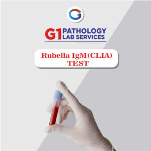 Rubella IgM