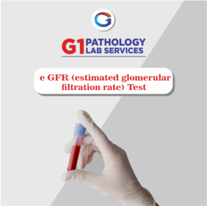 Estimated Glomerular Filtration Rate