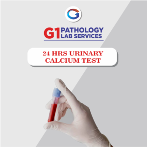 24 Hrs Urinary Calcium