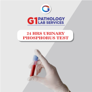 24 HRS URINARY PHOSPHORUS