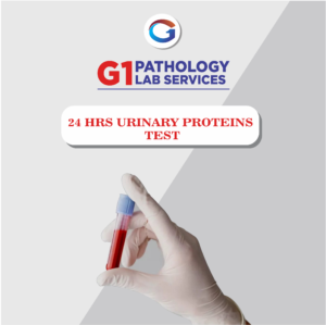 24 Hrs Urinary Protein