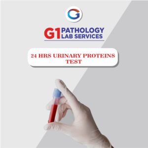 24 Hrs Urinary Protein