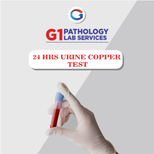 24 Hrs Urine Copper