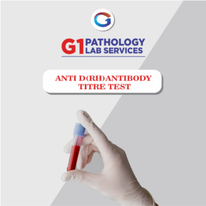 Anti D (Rh) Antibody Titre