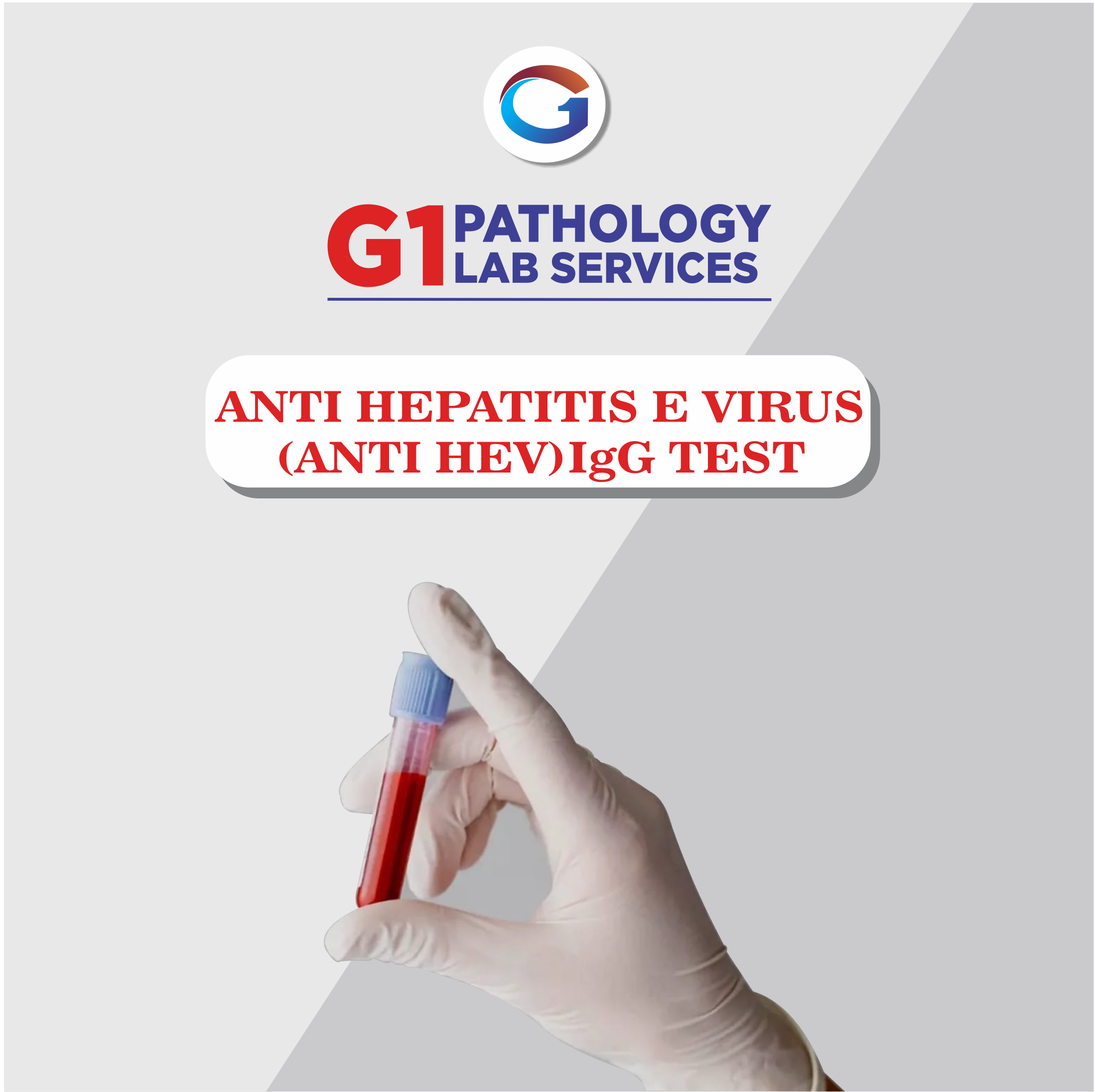 Anti Hepatitis E Virus (Anti Hev) Igg