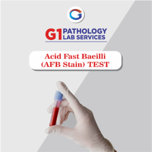 Acid Fast Bacilli (Afb Stain)