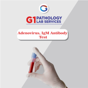 Adenovirus Igm Antibody