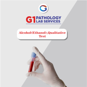 Alcohol(Ethanol),Qualitative