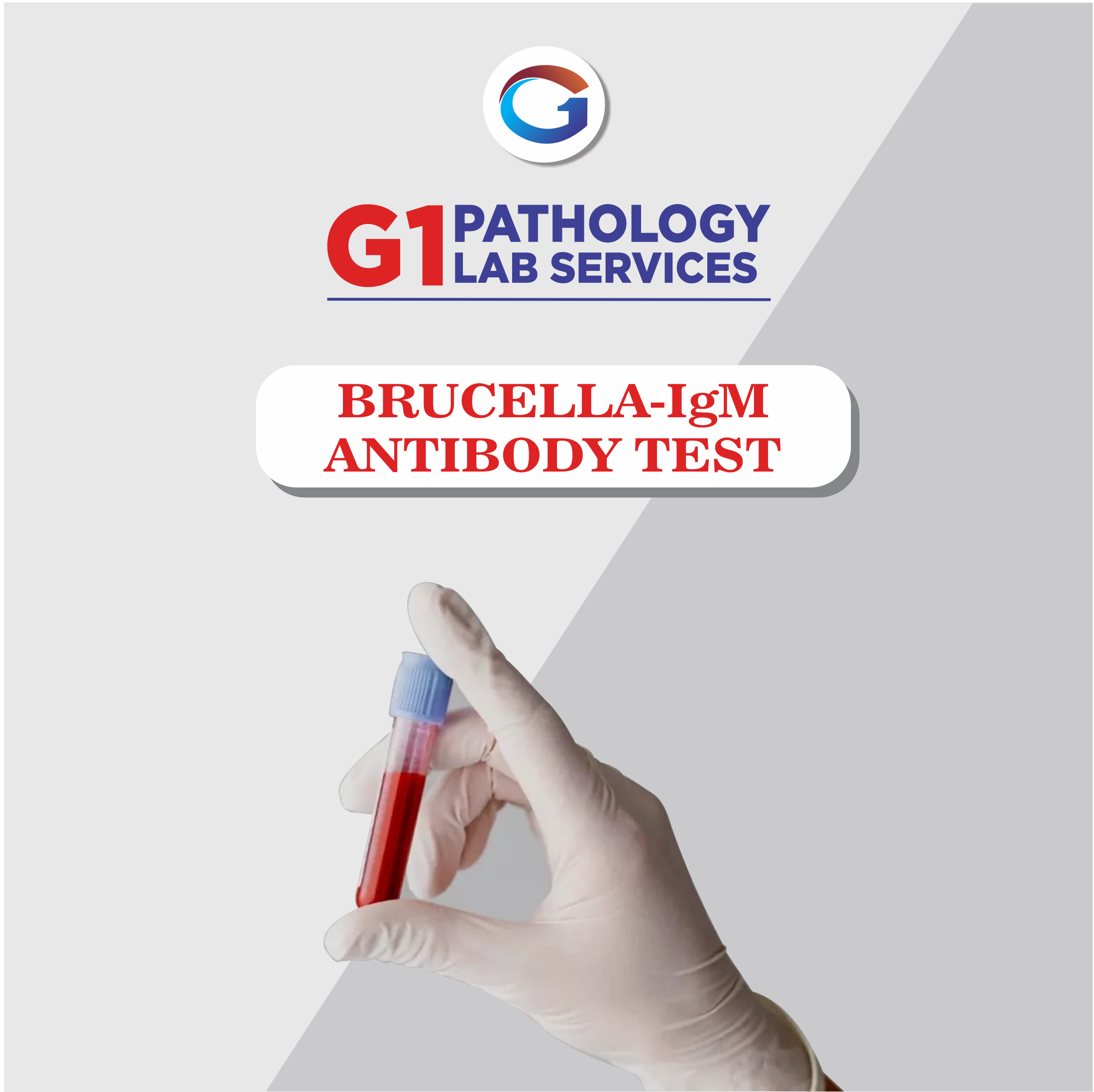 Brucella Igm Antibodies