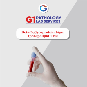 Beta-2-Glycoprotein I-Igm (Phospolipid)