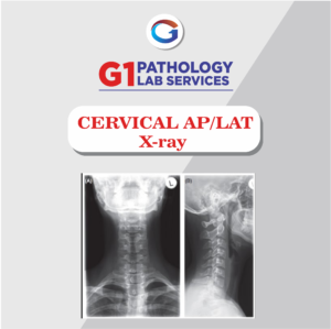 X-Ray Cervical AP/LAT