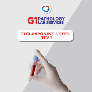 Cyclosporine Level