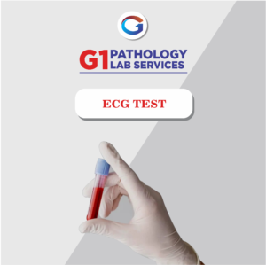 Ecg-Electrocardiogram