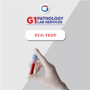 Ecg-Electrocardiogram