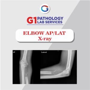 X-Ray Elbow AP/LAT