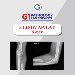 X-Ray Elbow AP/LAT