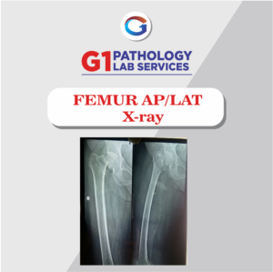 X-Ray Femur AP/LAT