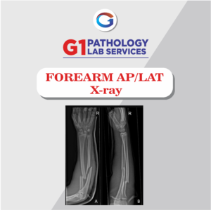 X-Ray Forearm AP/LAT
