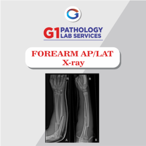 X-Ray Forearm AP/LAT