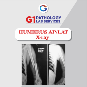 X-Ray Humerus AP/LAT