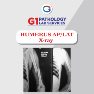 X-Ray Humerus AP/LAT