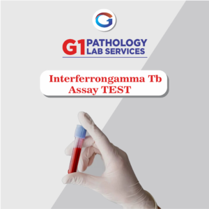 Interferon Gamma TB Assay