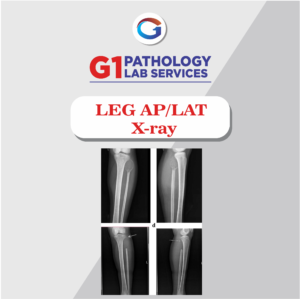 X-Ray Leg AP/LAT