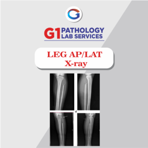 X-Ray Leg AP/LAT