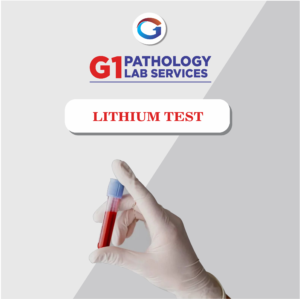 SR Lithium