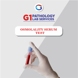 SR Osmolarity