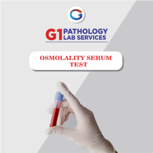 SR Osmolarity