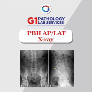 X-Ray PBH AP/LAT