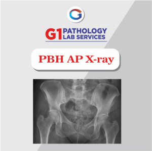 X-Ray PBH AP