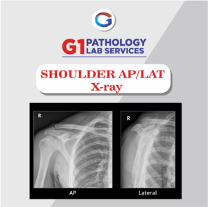 X-Ray Shoulder AP/LAT