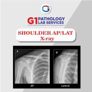 X-Ray Shoulder AP/LAT
