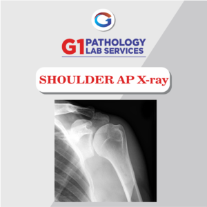 X-Ray Shoulder AP